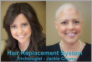 Solutions For Chemo Patients With Hair Loss - Healthy Hair Clinic
